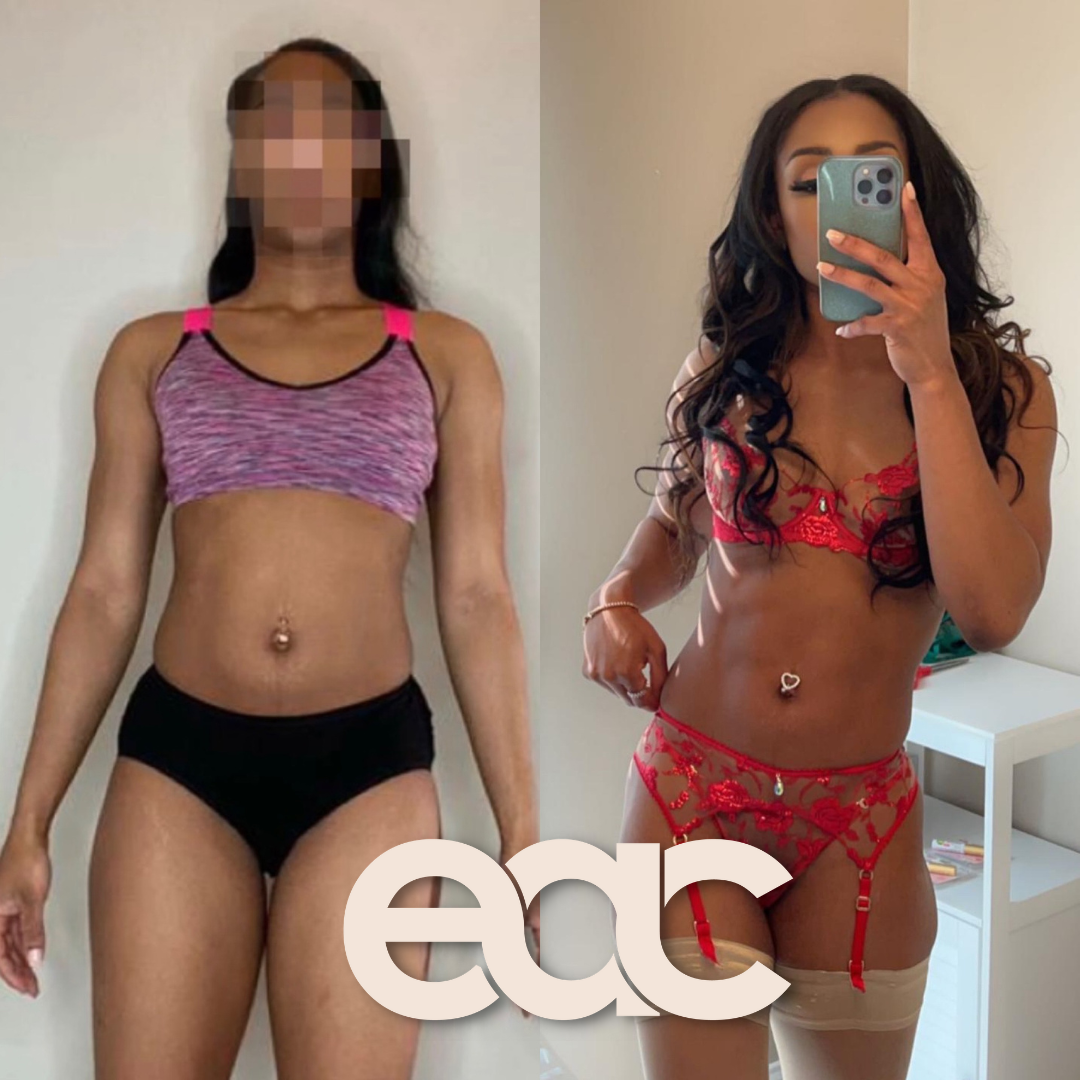 Copy of Copy of EMILY ANN - TRANSFORMATION POST (8)